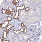 Immunohistochemical staining of human kidney shows strong membranous positivity in cells in distal tubules.