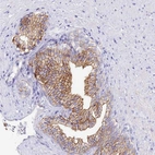 Immunohistochemical staining of human prostate shows moderate membranous positivity in glandular cells.