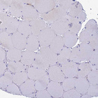 Immunohistochemical staining of human skeletal muscle shows no positivity in myocytes as expected.