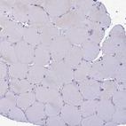 Immunohistochemical staining of human skeletal muscle shows no positivity in myocytes as expected.