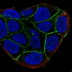 Immunofluorescent staining of human cell line RT4 shows localization to cell junctions.