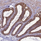 Anti-LZTS2 Antibody