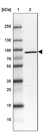 Lane 1: Marker [kDa] 250, 130, 100, 70, 55, 35, 25, 15, 10_br/_Lane 2: Human Tonsil tissue