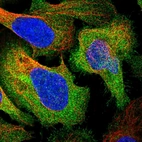Immunofluorescent staining of human cell line U-2 OS shows localization to plasma membrane & cytosol.