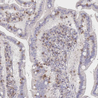 Immunohistochemical staining of human small intestine shows moderate cytoplasmic positivity in lymphoid cells.