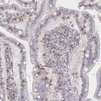 Immunohistochemical staining of human small intestine shows moderate cytoplasmic positivity in lymphoid cells.