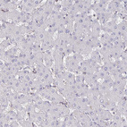 Immunohistochemical staining of human liver shows no positivity in hepatocytes as expected.