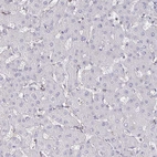 Immunohistochemical staining of human liver shows no positivity in hepatocytes as expected.