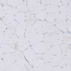 Immunohistochemical staining of human skeletal muscle shows no positivity in myocytes as expected.