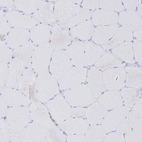 Immunohistochemical staining of human skeletal muscle shows no positivity in myocytes as expected.