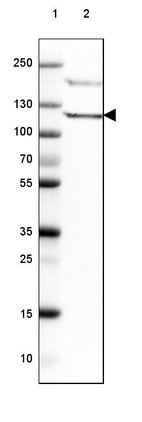 Lane 1: Marker [kDa] 250, 130, 100, 70, 55, 35, 25, 15, 10_br/_Lane 2: Human Tonsil tissue