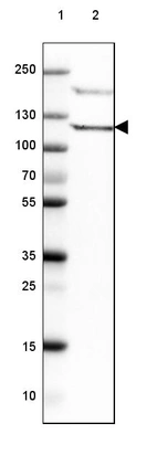 Lane 1: Marker [kDa] 250, 130, 100, 70, 55, 35, 25, 15, 10_br/_Lane 2: Human Tonsil tissue