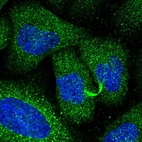 Immunofluorescent staining of human cell line U-2 OS shows localization to cytokinetic bridge & vesicles.