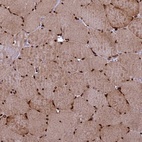 Anti-TCEA3 Antibody