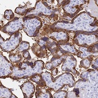 Anti-C2orf72 Antibody