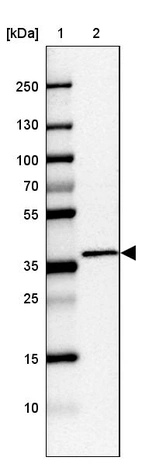 Lane 1: Marker [kDa] 250, 130, 100, 70, 55, 35, 25, 15, 10_br/_Lane 2: Human cell line CACO-2