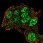 Anti-C2orf72 Antibody