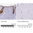 Anti-CST6 Antibody