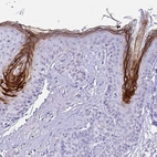 Immunohistochemical staining of human skin shows strong cytoplasmic positivity in stratum granolosum.