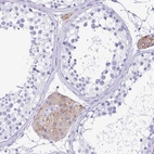 Immunohistochemical staining of human testis shows moderate cytoplasmic positivity in Leydig cells.