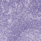 Immunohistochemical staining of human lymph node shows no cytoplasmic positivity in non-germinal center cells as expected.