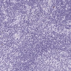 Immunohistochemical staining of human lymph node shows no cytoplasmic positivity in non-germinal center cells as expected.