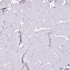 Immunohistochemical staining of human skeletal muscle shows no cytoplasmic positivity in myocytes as expected.