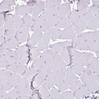 Immunohistochemical staining of human skeletal muscle shows no cytoplasmic positivity in myocytes as expected.