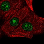 Immunofluorescent staining of human cell line MCF7 shows localization to nucleus & nucleoli.