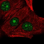 Immunofluorescent staining of human cell line MCF7 shows localization to nucleus & nucleoli.