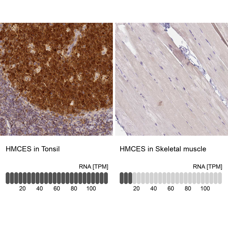 Anti-HMCES Antibody