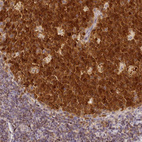 Immunohistochemical staining of human tonsil shows strong nuclear positivity in germinal center cells.