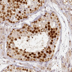 Immunohistochemical staining of human testis shows strong nuclear positivity in cells in seminiferous ducts.