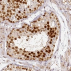 Immunohistochemical staining of human testis shows strong nuclear positivity in cells in seminiferous ducts.