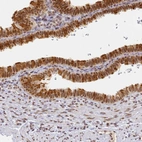 Immunohistochemical staining of human Fallopian tube shows strong nuclear positivity in glandular cells.
