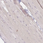 Immunohistochemical staining of human skeletal muscle shows no positivity in myocytes as expected.