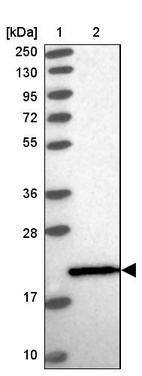 Lane 1: Marker [kDa] 250, 130, 95, 72, 55, 36, 28, 17, 10_br/_Lane 2: Human cell line RT-4