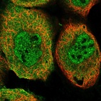 Immunofluorescent staining of human cell line A-431 shows localization to nucleoplasm & cytosol.