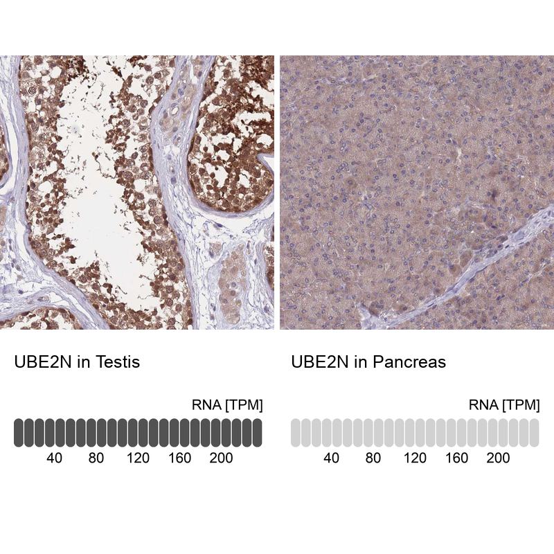 Anti-UBE2N Antibody