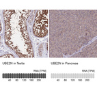 Anti-UBE2N Antibody