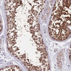 Immunohistochemical staining of human testis shows high expression.