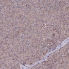 Anti-UBE2N Antibody