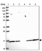 Lane 1: Marker [kDa] 250, 130, 95, 72, 55, 36, 28, 17, 10_br/_Lane 2: Human cell line RT-4_br/_Lane 3: Human cell line U-251MG sp_br/_Lane 4: Human plasma (IgG/HSA depleted)_br/_Lane 5: Human liver tissue_br/_Lane 6: Human tonsil tissue