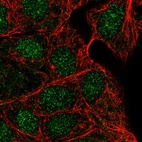 Immunofluorescent staining of human cell line RT4 shows localization to nucleus.