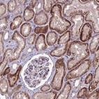 Anti-C2orf76 Antibody