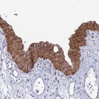 Anti-THAP4 Antibody