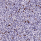 Immunohistochemical staining of human spleen shows strong cytoplasm granular positivity in cells in red pulp.
