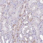 Immunohistochemical staining of human kidney shows strong cytoplasm granular positivity in cells in proximal tubules.