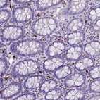 Immunohistochemical staining of human colon shows strong cytoplasm granular positivity in lymphocytes.