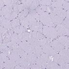 Immunohistochemical staining of human skeletal muscle shows no positivity in myocytes as expected.